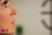 سعر عملية تجميل الأنف