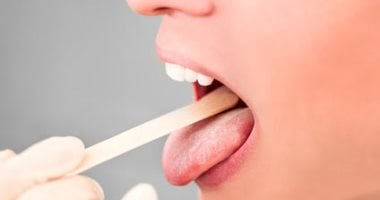 تبدأ من السحور.. استشارى يقدم وصفة لتجنب جفاف الفم في الصيام