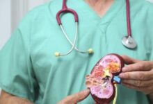 علامات خفية لأمراض الكلى علامات خفية لأمراض الكلى