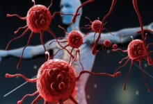 5 عادات يومية قد تزيد خطر الإصابة بالسرطان