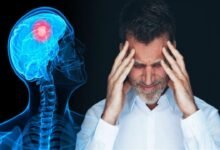 أعراض ورم الرأس في بدايته