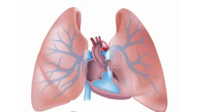 ارتفاع ضغط الدم الرئوي