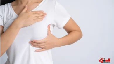 تجارب السيدات مع الورم الليفي في الثدي