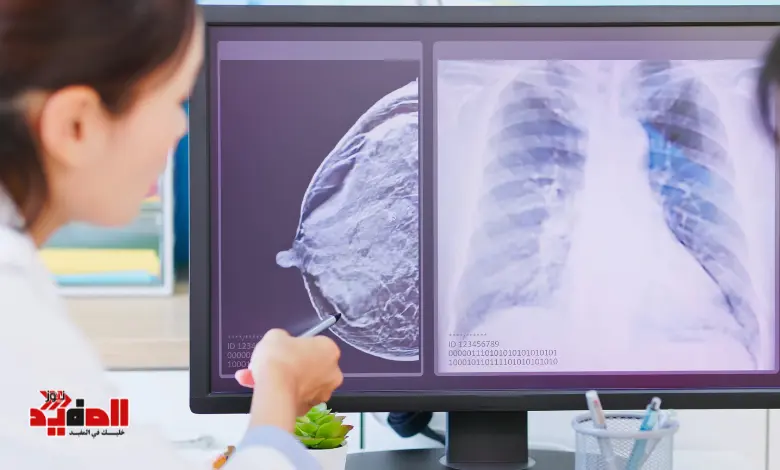 كيفية الكشف عن سرطان الثدي