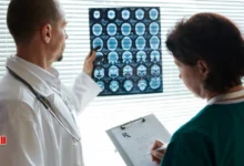 نسبة الشفاء من ورم الدماغ