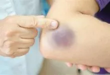 الجسم يحذّر بصمت.. علامات مبكرة لأمراض شائعة لا يجب تجاهلها