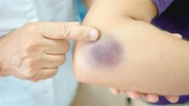 الجسم يحذّر بصمت.. علامات مبكرة لأمراض شائعة لا يجب تجاهلها الجسم يحذّر بصمت.. علامات مبكرة لأمراض شائعة لا يجب تجاهلها