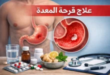 علاج قرحة المعدة