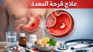 علاج قرحة المعدة