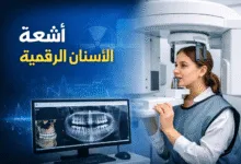 أشعة الأسنان الرقمية .. تشخيص دقيق وسريع مع أقل تعرض للإشعاع