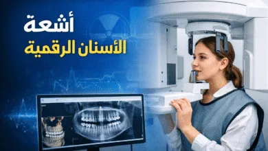 أشعة الأسنان الرقمية .. تشخيص دقيق وسريع مع أقل تعرض للإشعاع