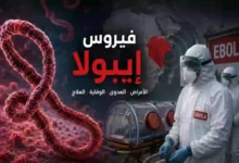 فيروس إيبولا: الأعراض وطرق العدوى والوقاية من المرض القاتل